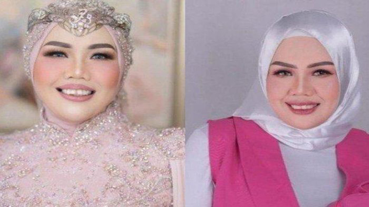 Elly Sugigi Jalani Operasi Plastik Demi Bangun Kepercayaan Diri dan Tinggalkan Hujatan